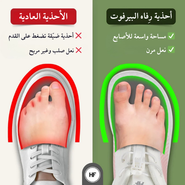 أحذية رِفاه البيرفوت – لتخفيف آلام القدم، الركبة والظهر (للجنسين)