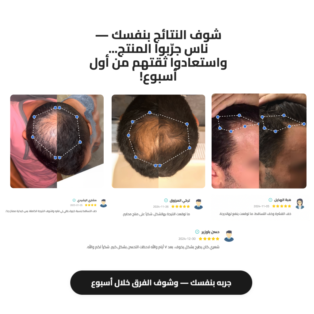 سيروم رول-أون لنمو الشعر Bodywise